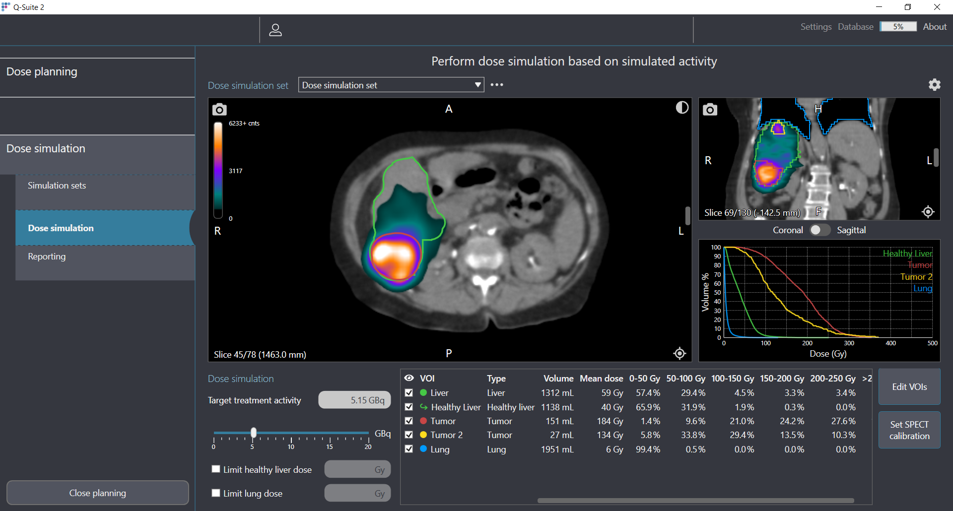 QuiremSpheres™ Microspheres